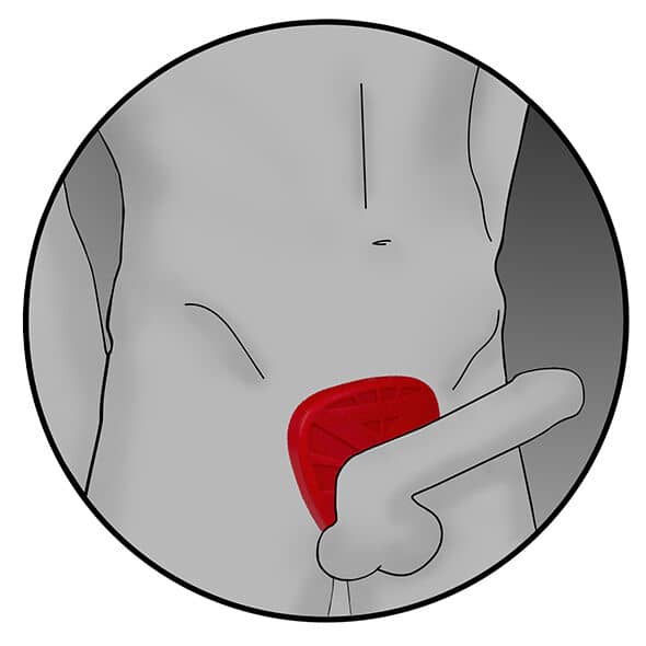 ELECTRASTIM – SILICONE FUSION